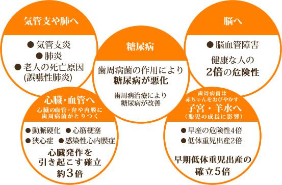 重度の歯周病炎症物質や毒素により 糖尿病が悪化口の中の歯周病菌が 体内旅行に出て、 いろいろな悪さを!! 気管支や肺へ気管支炎肺炎老人の死亡原因 (誤嚥性肺炎) 脳へ脳血管障害健康な人の 2倍の危険性 心臓・血管へ心臓の血管・弁や内膜に 歯周病菌がとりつく動脈硬化心筋梗塞狭心症感染性心内膜症心臓発作を 引き起こす確立約3倍  歯周病菌は 赤ちゃんをおびやかす子宮・羊水へ（胎児の成長に影響）早産の危険性4倍低体重児出産2倍なんと早期低体重児出産の 確立5倍