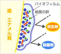 歯のスペシャルケア「PTMC」のイメージ